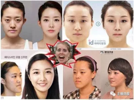 为什么在韩国整容如此盛行 看点快报