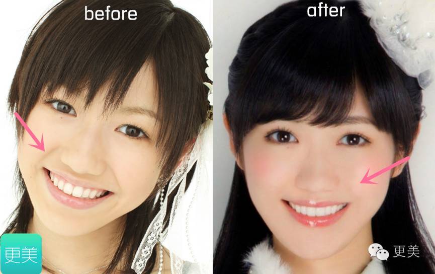 萌脸有毒!19岁竟毫不费力地撩到了王力宏