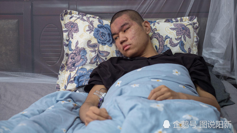 7旬外婆拖着假腿 为无关血癌外孙摆早点摊凑