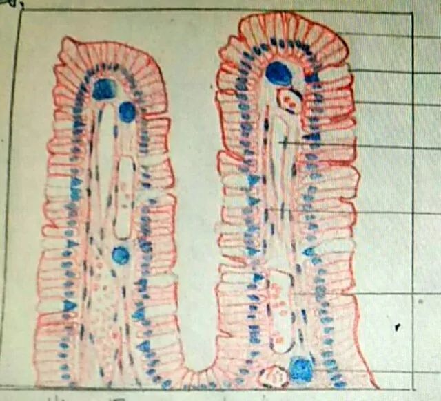 胆囊的单层柱状细胞