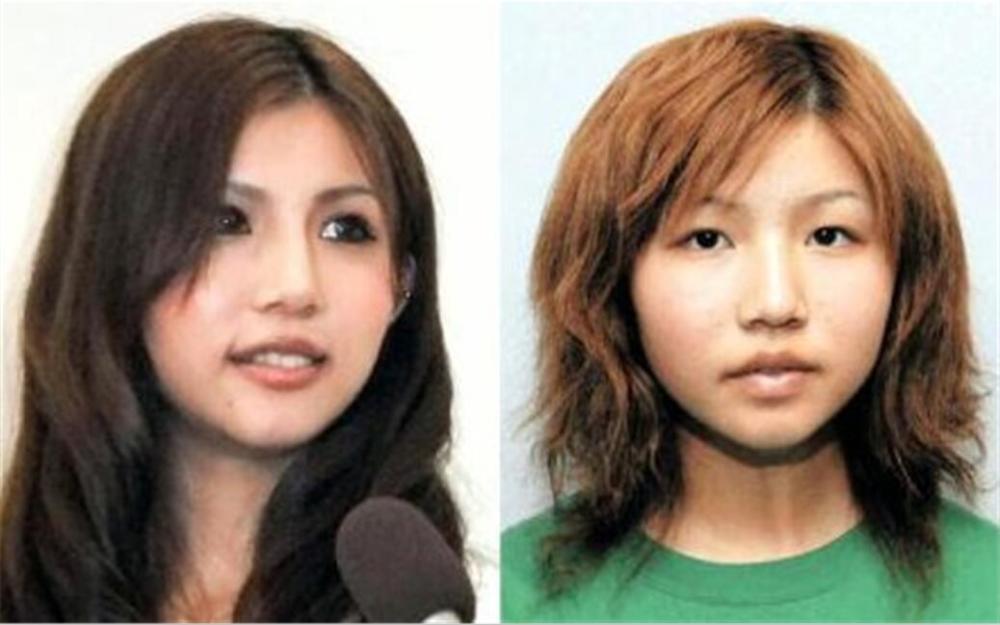 张日本演员网红艺人整容前后对比图 失败成功五五开 看点快报