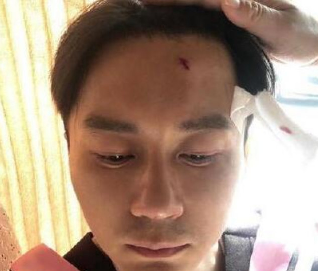 综艺节目中发生意外,李晨头部受伤,王宝强右脚