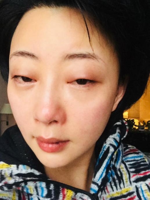殷桃拍哭戏卸妆后眼睛红肿,双眼皮哭成单眼皮,演技比杨颖过硬