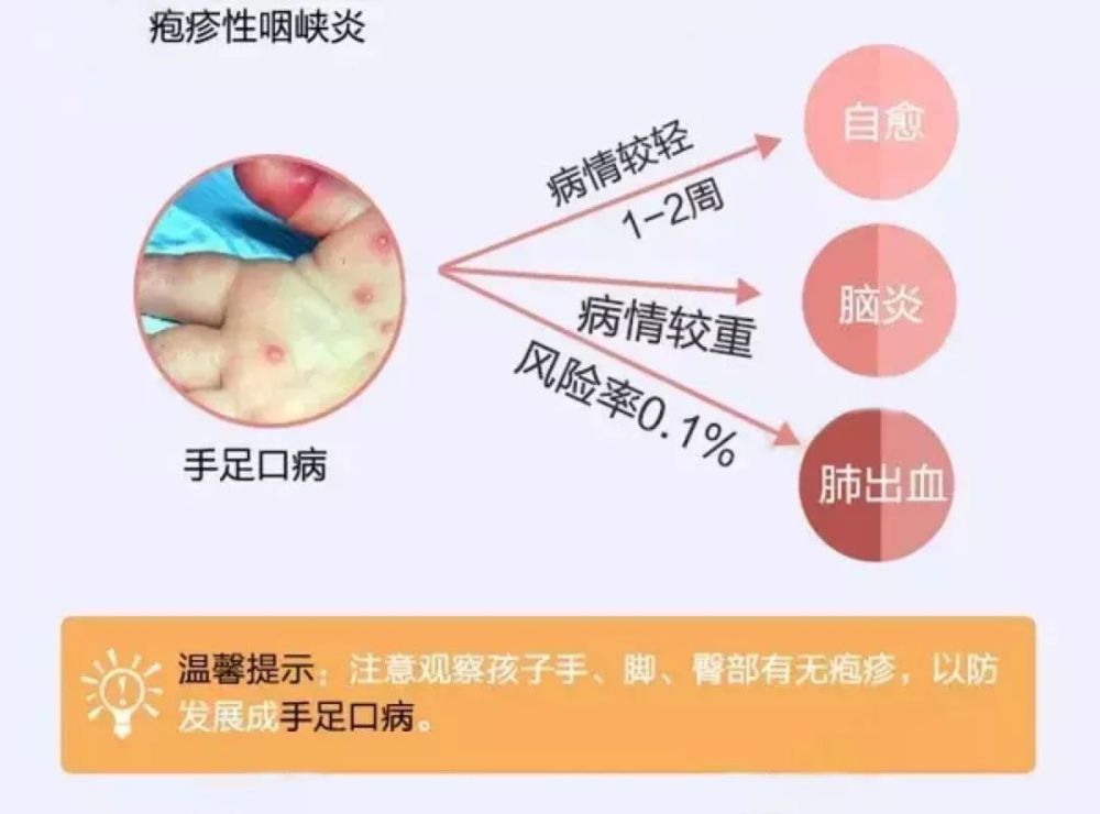 疱疹性 腾讯网