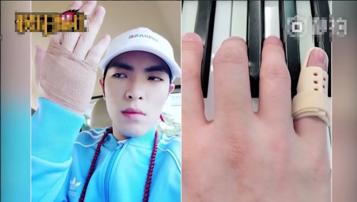 太拼！萧敬腾和罗大佑尬琴致手指骨裂，怕影响演出坚持不去看医生