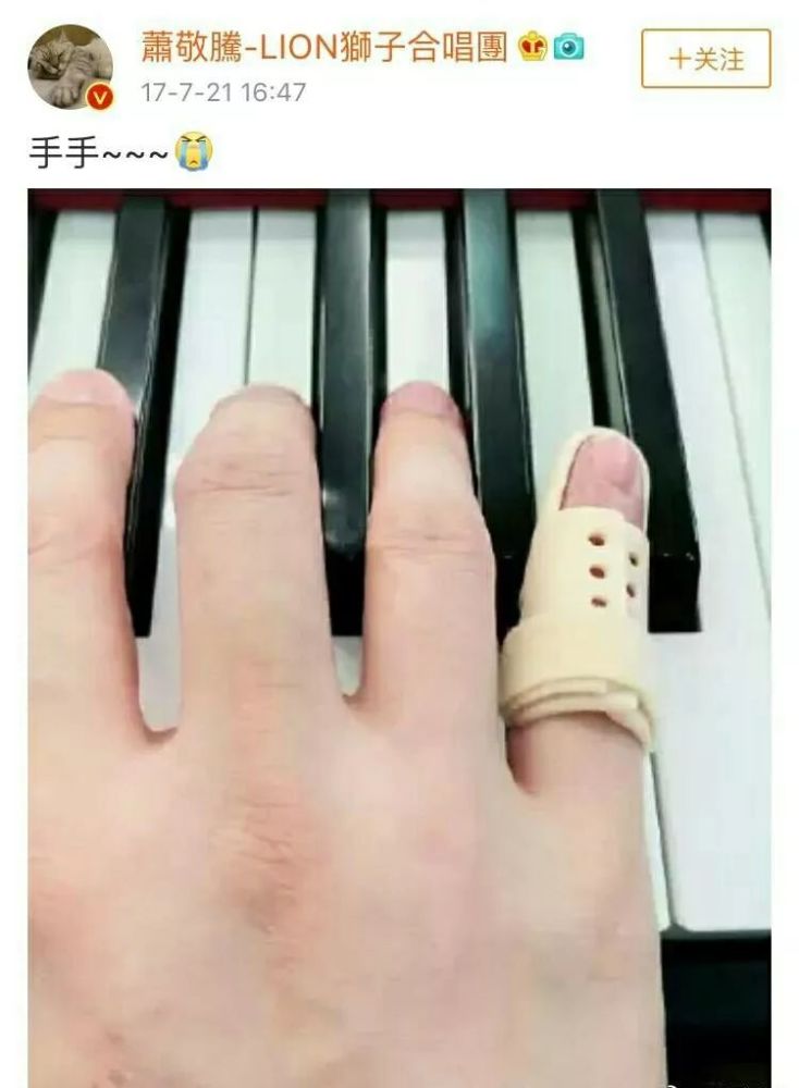 萧敬腾手疑似骨裂,为表演不看医生