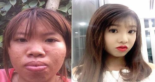 丑女整形成功嫁富二代生子 半年后离婚收场 再嫁获幸福 天天快报