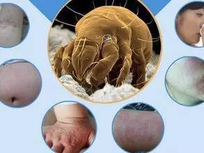 这份毒虫咬伤急救手册夏天用得着!