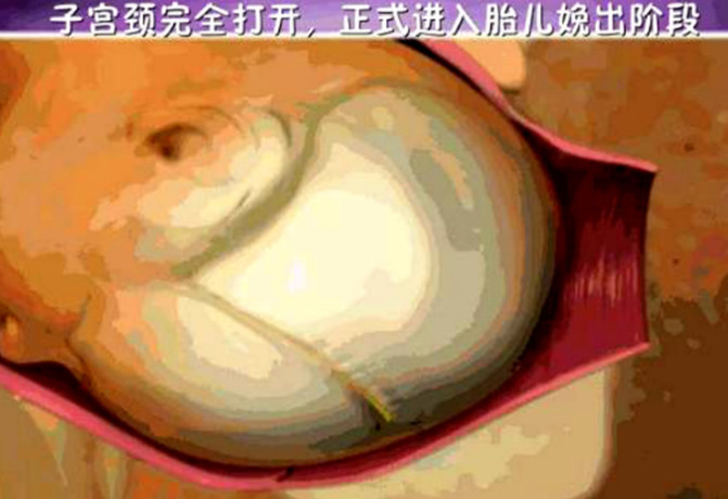 这五张图片是女性顺产的整个过程,看到泪目,母爱太沉重