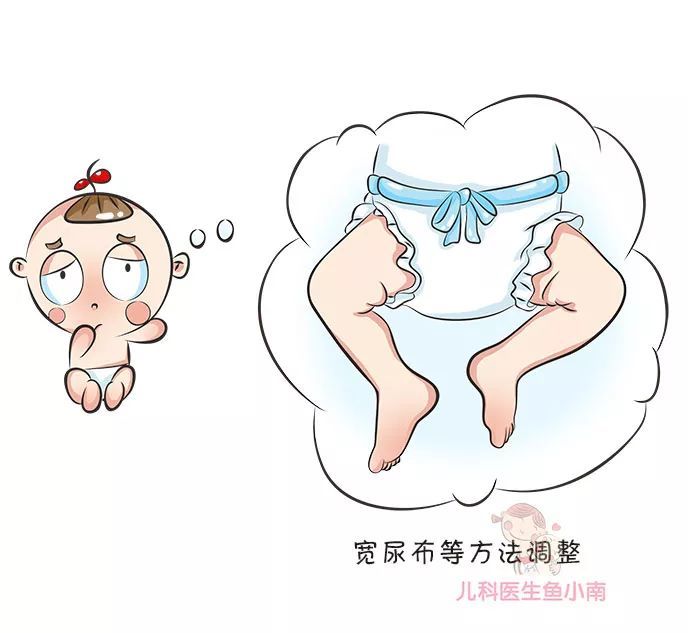 宝宝腿纹不对称就是髋关节发育不良吗?越早发现越好