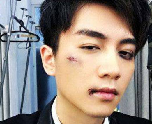 明星拒绝用替身,杨幂差点毁容,陈晓被打45个耳