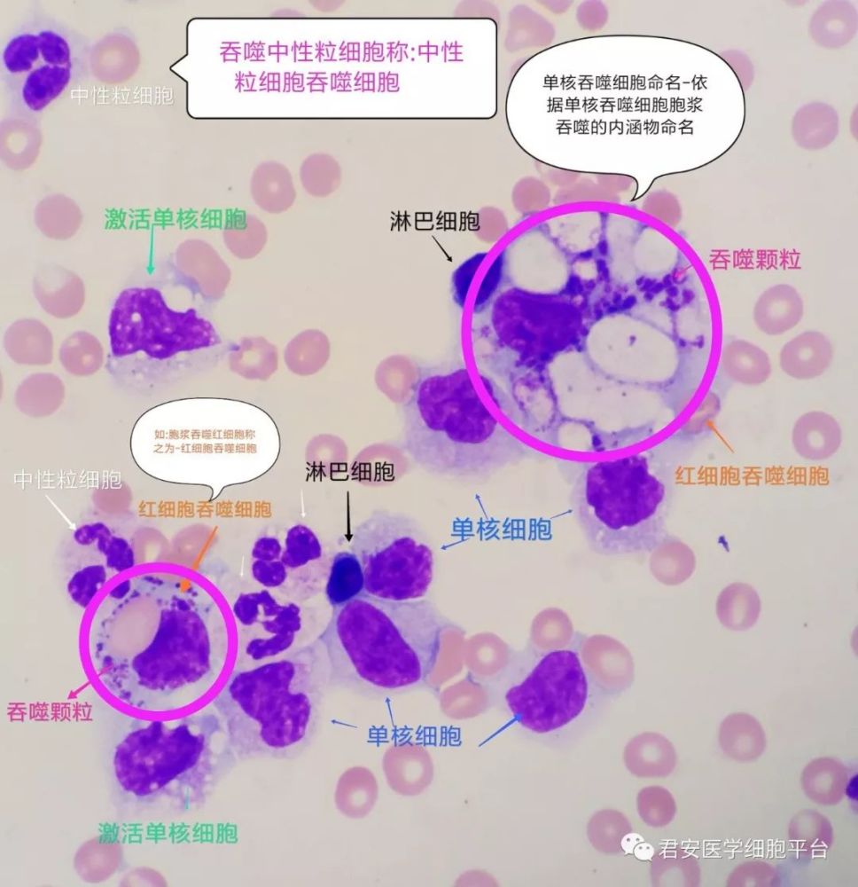 脑脊液单核巨噬细胞的"别样风情"