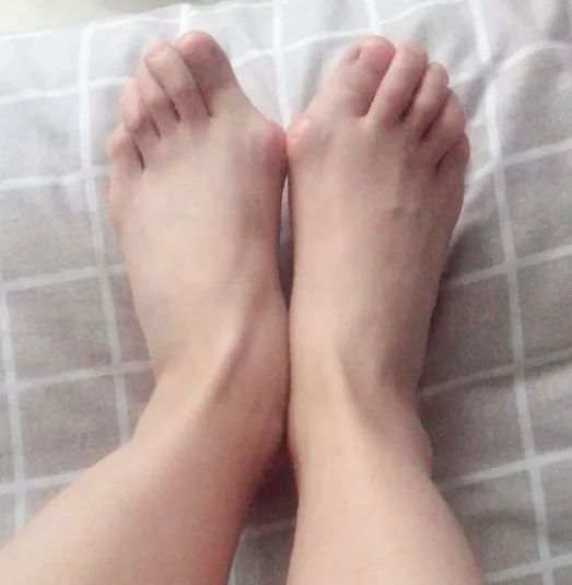 走路脚疼?我来帮你解决