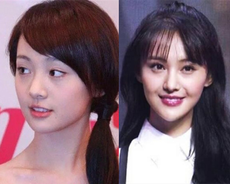 可惜了好底子,这些年越整越丑的女星,除了张檬郑爽还有谁?