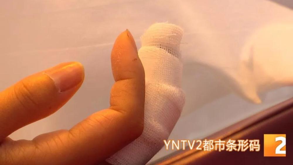 惊恐 发生了什么 女子在酒店上卫生间 手指竟然被门夹断 酒店回应说 看点快报