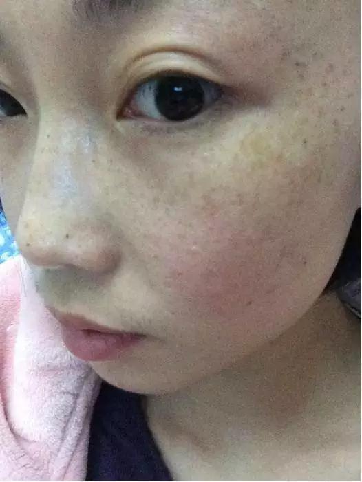 相信我们每个人都希望自己的脸色红润,可是随着年岁的增长,皮肤渐渐