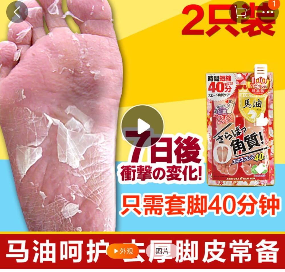 林允敷脚膜画面太吓人,整个脚脱皮网友看着都