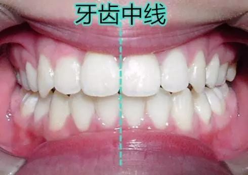 沈月丑还有救,而他的脸再不治会成下一个脸歪