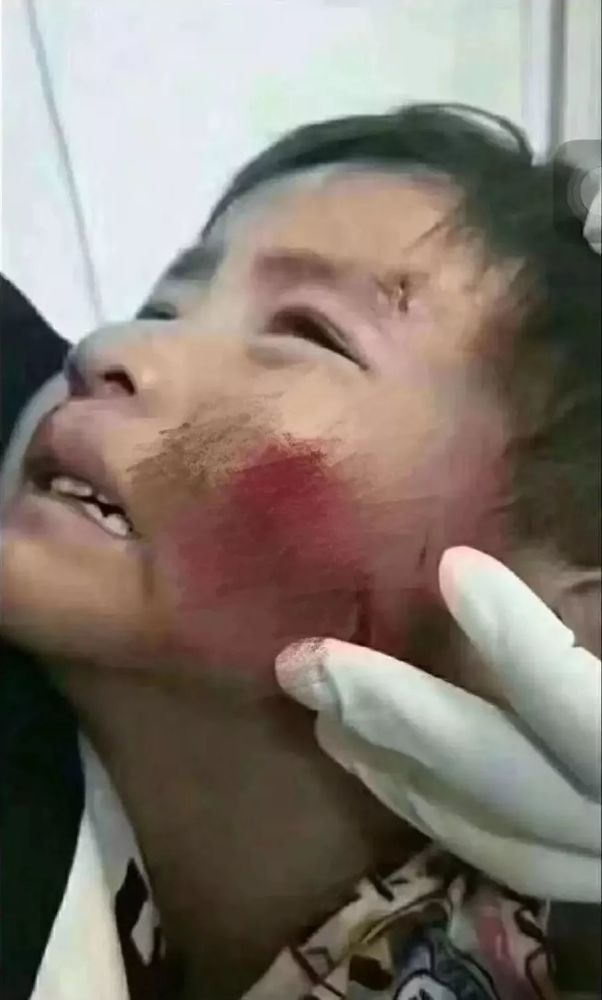 提醒那些遛狗人士,出门请给狗套绳子,不要总说狗很乖,不咬人,那是没