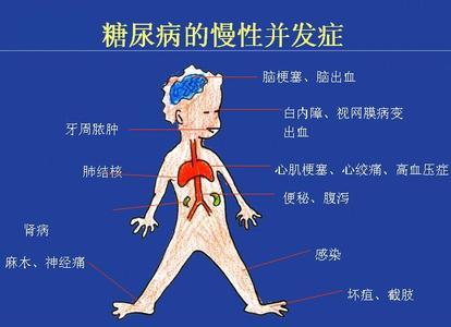 高血糖的人手脚有这三种变化,可能是糖尿病早期的表现