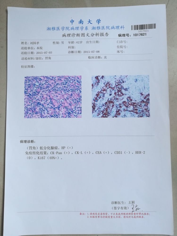 病理诊断:低分化胃腺癌.hp( ).