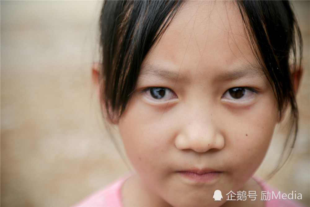 大眼睛女孩酷似希望工程代言人!可她要失明了