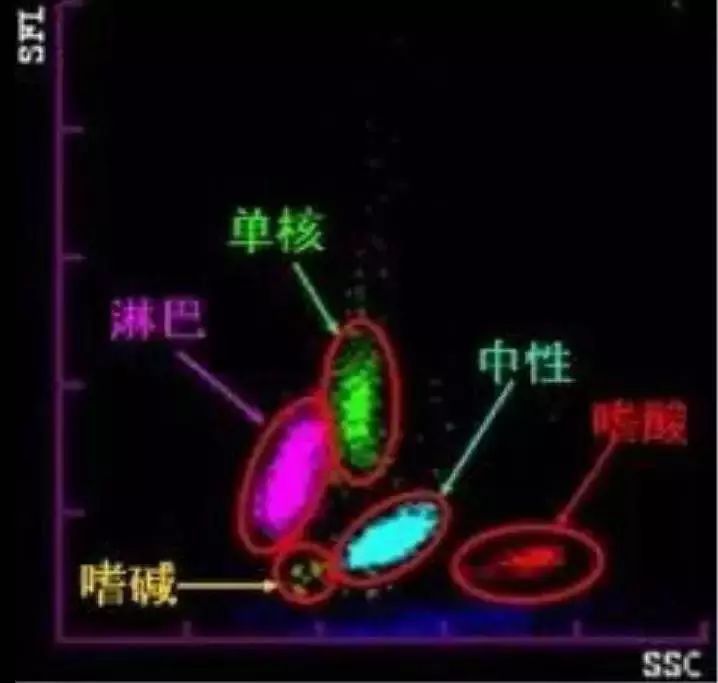 单核细胞型为主的异常淋巴细胞常见散点图