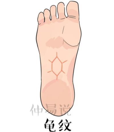 脚底有这3种纹,一生不愁吃喝不愁钱,福气