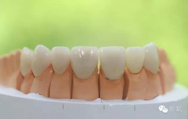 baby和杨幂都说自己是整牙变美,整牙到底多神