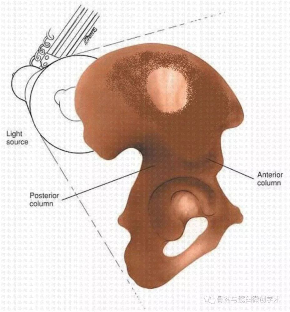 髋臼前柱及后柱的解剖