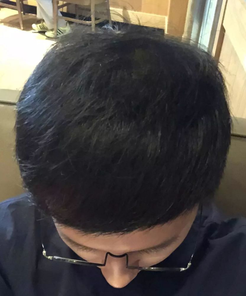 周末人生┃25岁脱发的男程序猿,从内心崩溃参悟佛学到