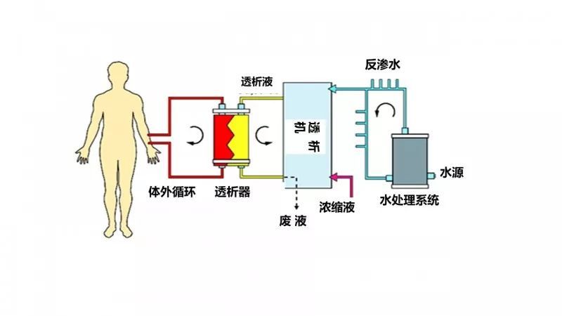 血液透析