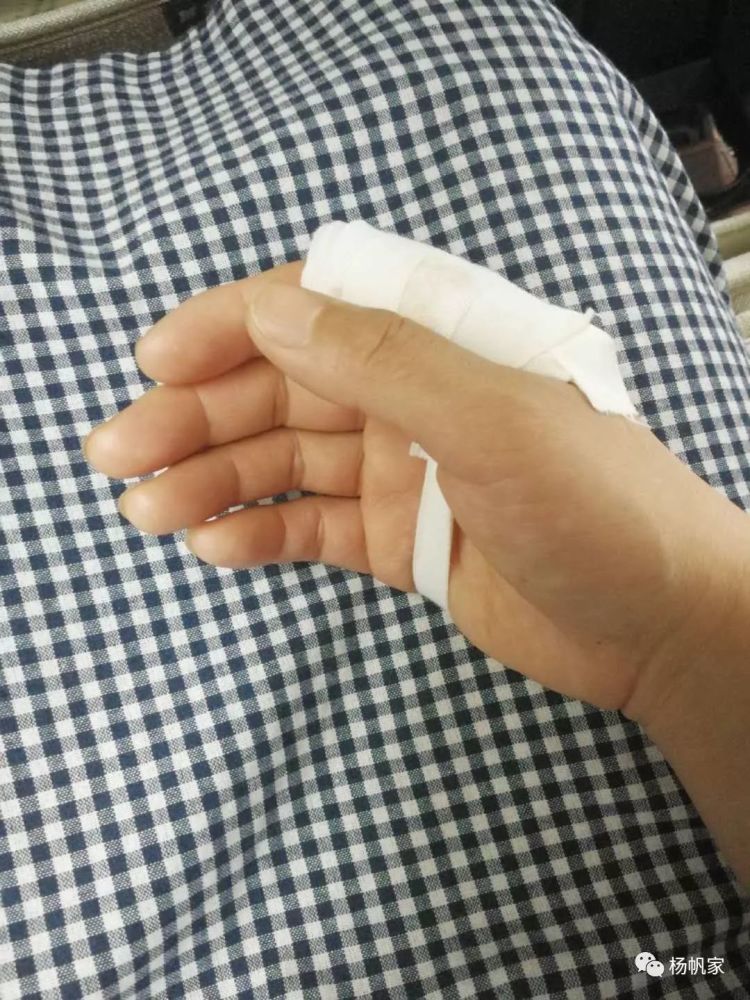 (包扎好的手)