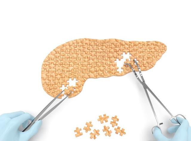 有这4个特征的人,最招胰腺癌喜欢!一个都没有