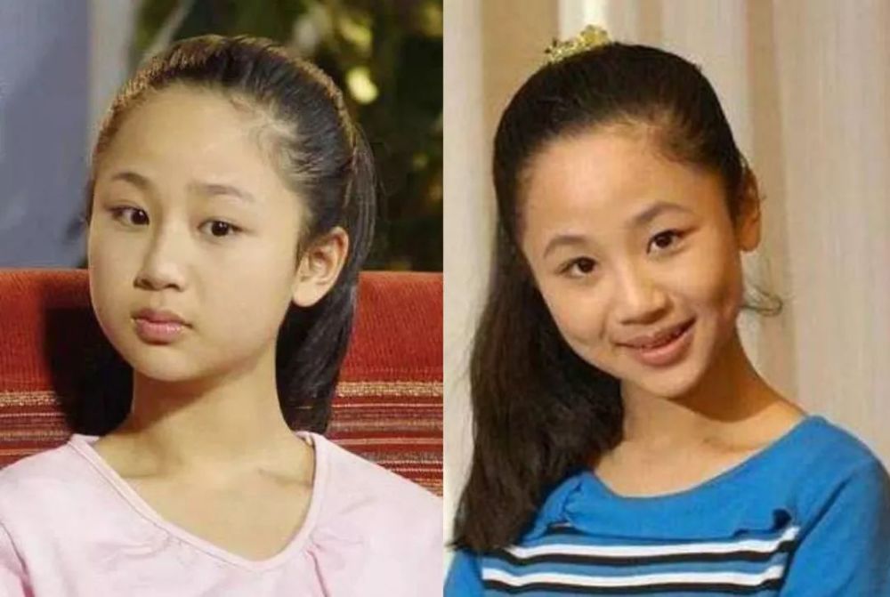 杨紫,整容