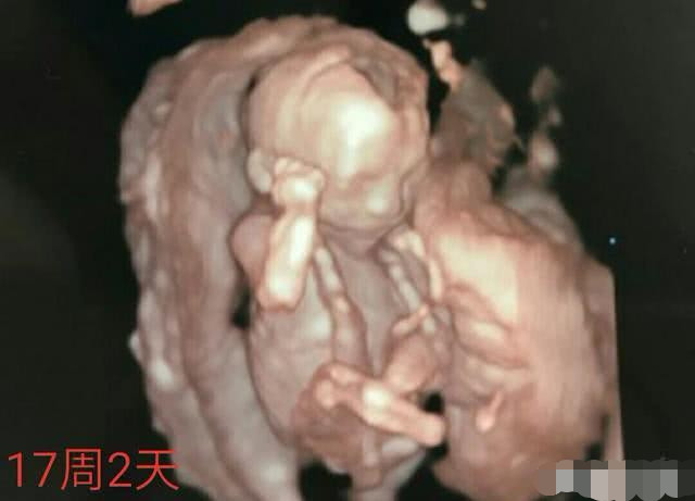 怀孕17周的时候,胎儿已经成型了吗?好想知道宝宝的样子呀?