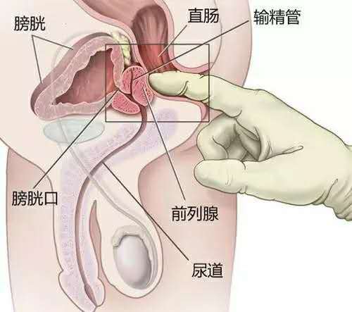 膀胱人口_女性膀胱位置