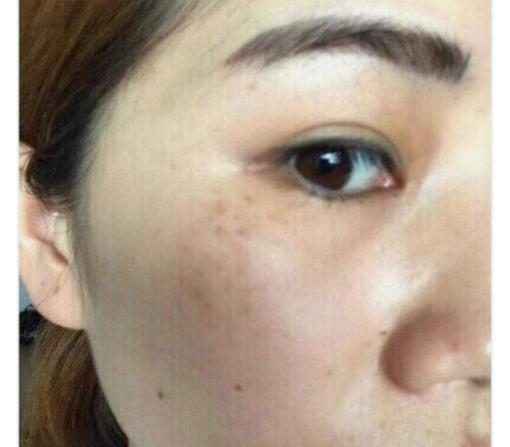 后来宁宁说了实话,自己20岁以后就每年都在长斑,用了很多贵价护肤品