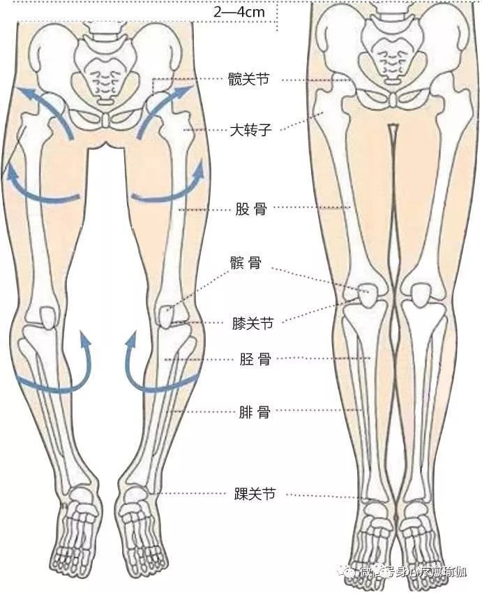 膝关节,踝关节失衡: 早期:骨盆前倾 股骨内旋 胫骨内旋 足外翻(xo型腿