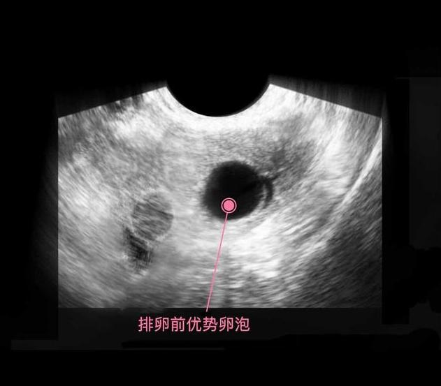 胎儿从卵泡到性别形成,17张图片清晰诠释,男宝女宝看