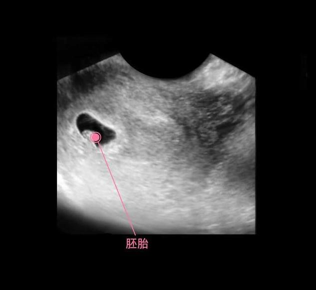 胎儿从卵泡到性别形成,17张图片清晰诠释,男宝女宝看