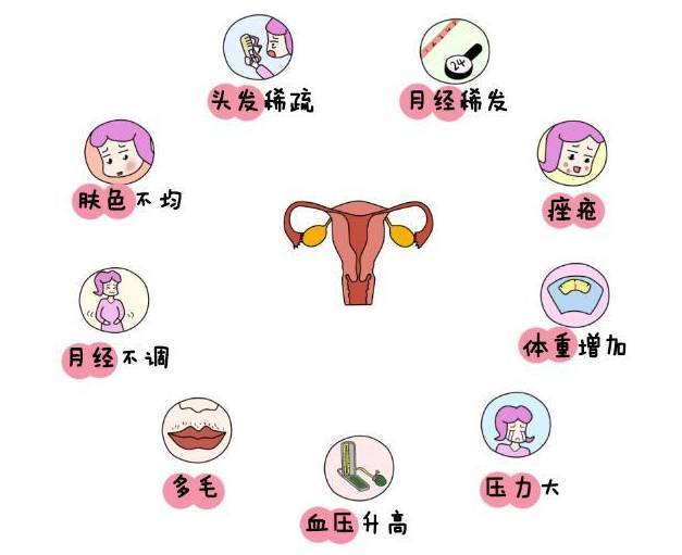 多囊卵巢综合征患者想怀孕,这些事你知道吗?