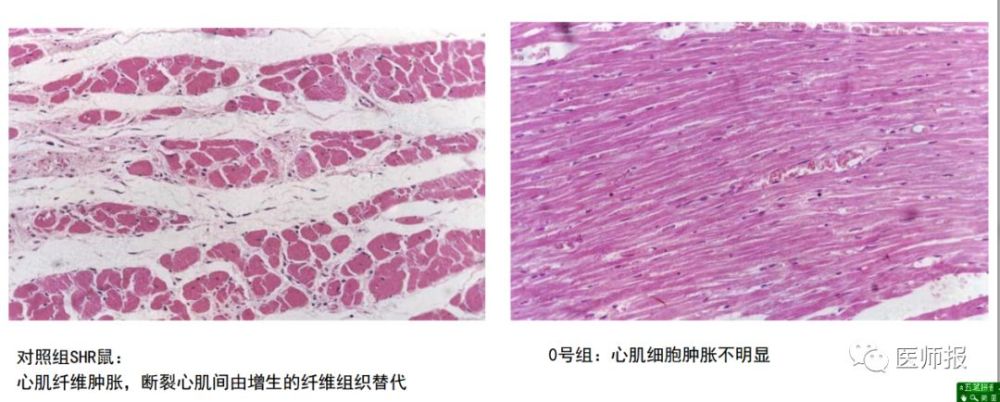 左图为未服用药物的心脏图片,可见明显心肌纤维肿胀,右图为服药后