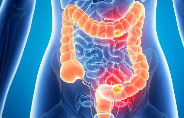 想清除肠道里的宿便,这4个方法很好用,简单方