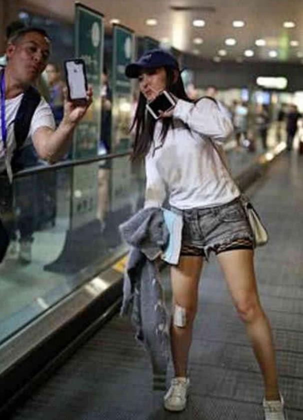 马苏现身机场和男子合影,腿上的伤惹人关注,网