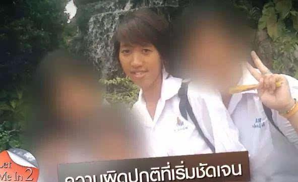 女子面部畸形像丑八怪,整容后,成为一名漂亮