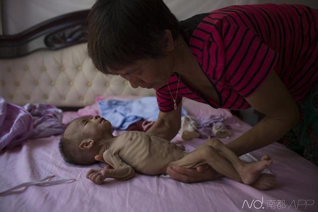 冻龄婴出生7月体重没长