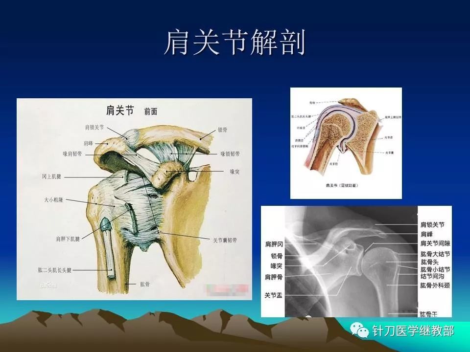 肩周炎标准针刀治疗