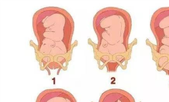 耻骨痛首先说明胎儿已经入盆了,受力向下明显.