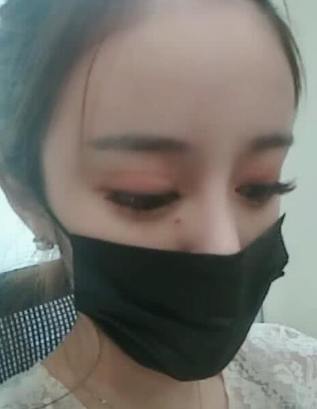 小姐姐抖音中哭诉花300万整容失败,卸载口罩一刻网友心肝疼